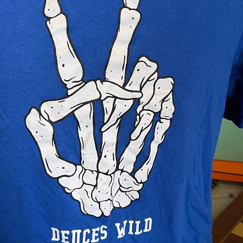 Skeleton hand 🖐️ - Picture 3 of 7